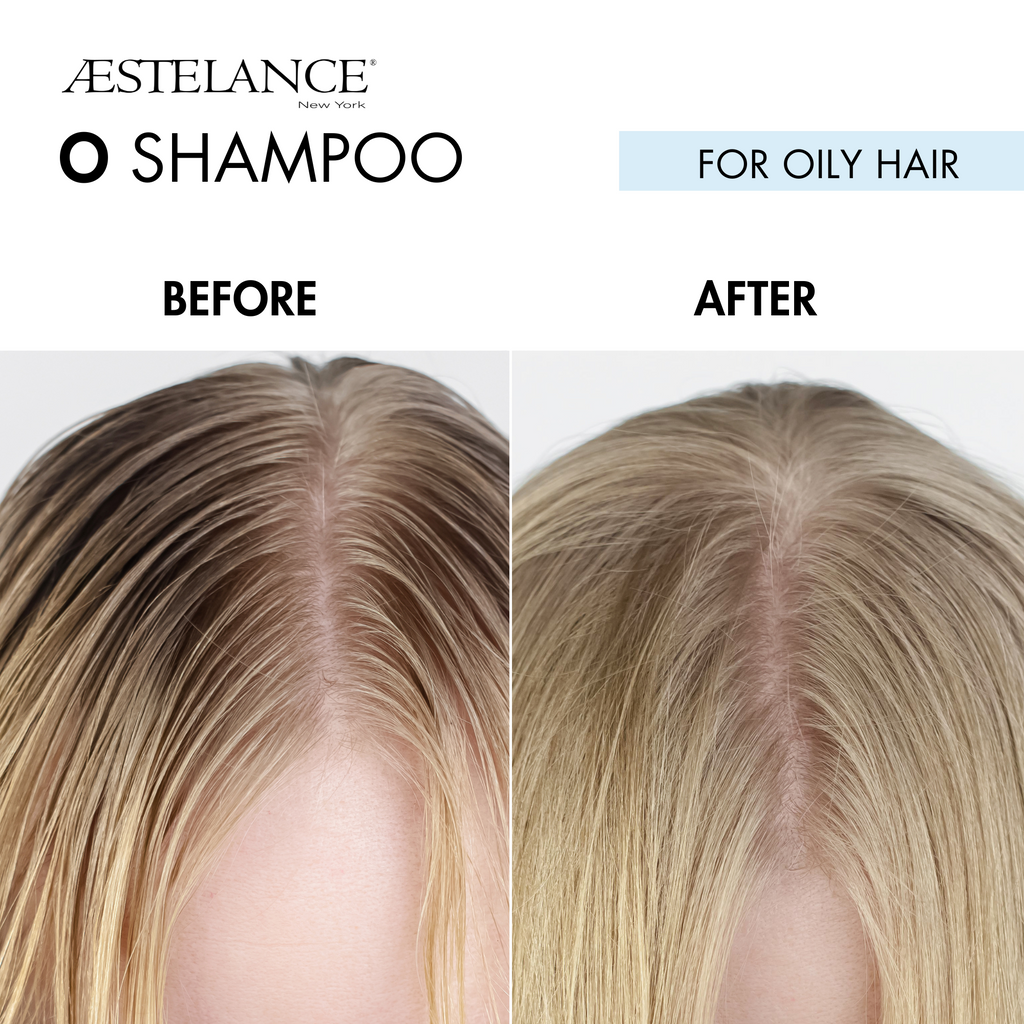 Aestelance O Shampoo for Oily Hair 8 oz