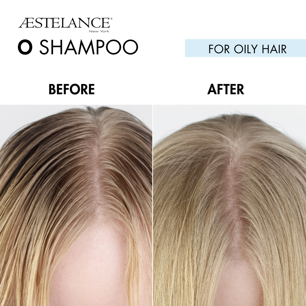 Aestelance O Shampoo for Oily Hair